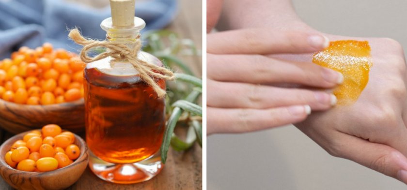 Облепиховое масло при ожогах Облепиховое масло при ожогах