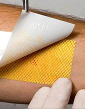 Ожог признаки и первая помощь