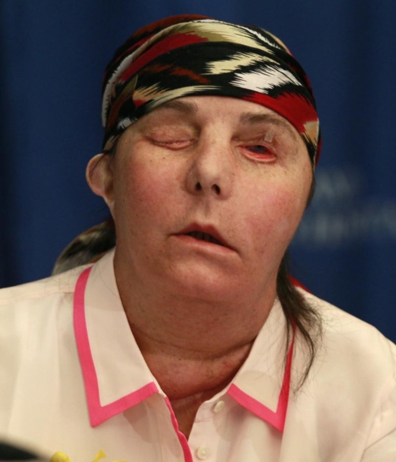 Одним ужасным днем мать двоих детей Конни Калп изуродовал выстрелом в лицо собственный муж. Вскоре после этого мужчина покончил с собой, а Конни, будучи настоящим бойцом, держалась и продолжала жить несмотря на тот ужас, через который ей пришлось про Одним ужасным днем мать двоих детей Конни Калп изуродовал выстрелом в лицо собственный муж. Вскоре после этого мужчина покончил с собой, а Конни, будучи настоящим бойцом, держалась и продолжала жить несмотря на тот ужас, через который ей пришлось про