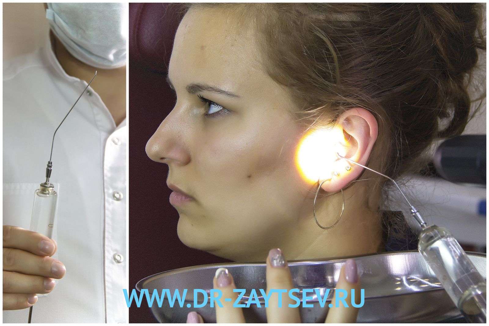 Как лечить острый отит среднего уха