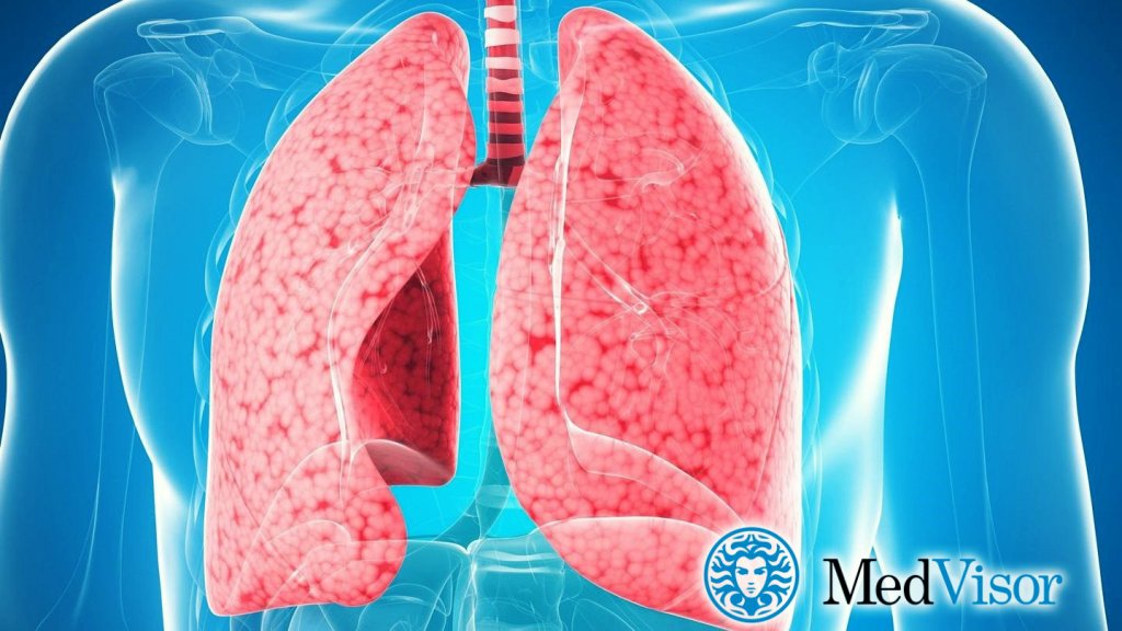 Может ли бронхит перейти в пневмонию? Что хуже обструктивный бронхит или пневмония