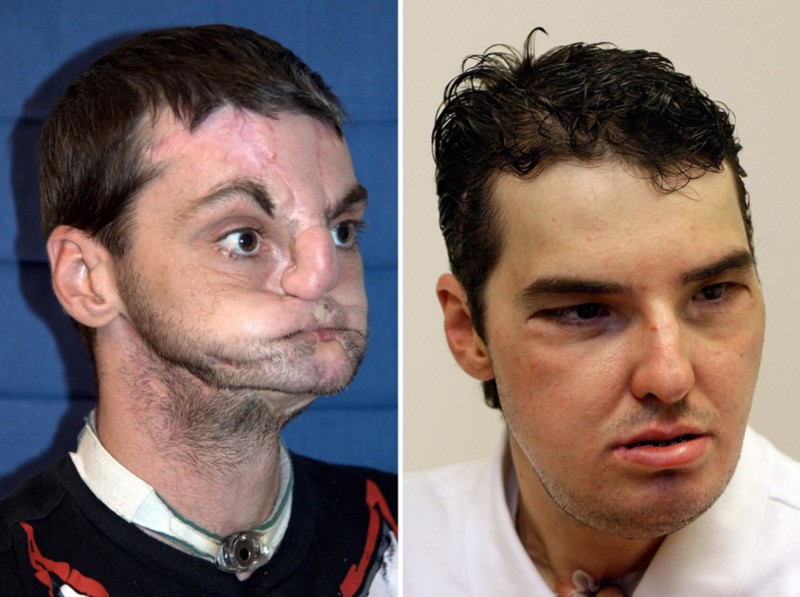 5. Ричард Норрис 5. Ричард Норрис