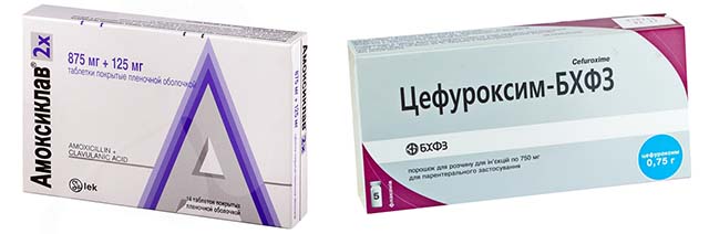 Цефуроксим и Амоксиклав