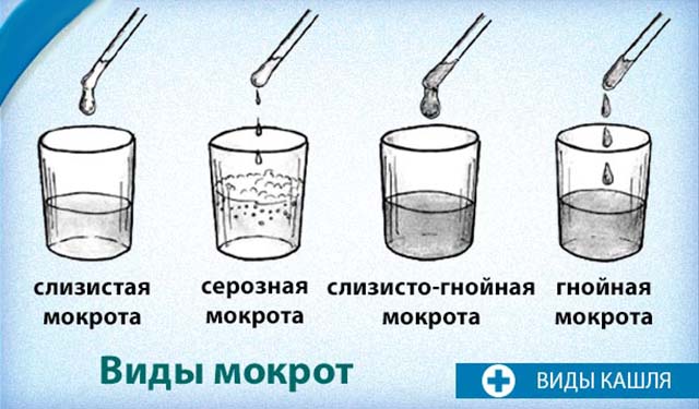 Виды мокрот