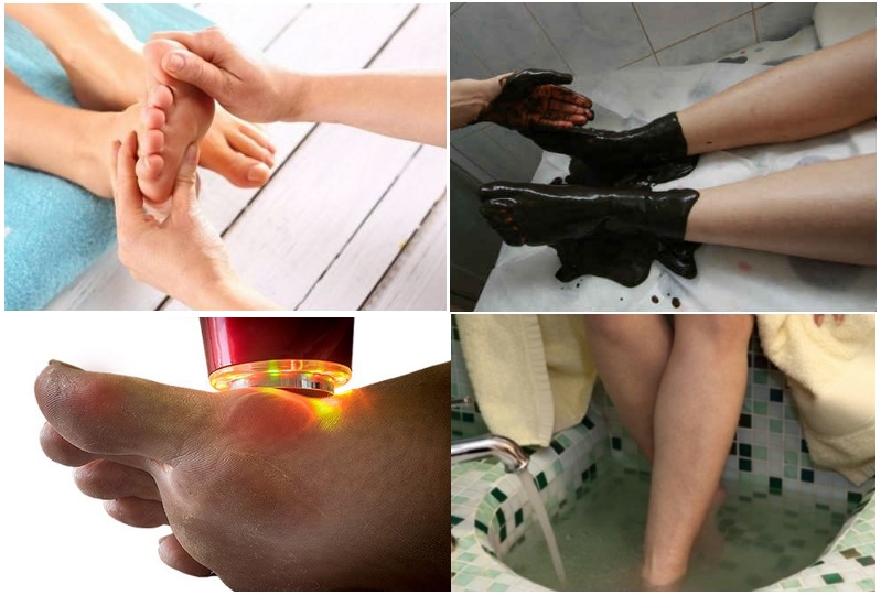 Физиолечение при подагре Физиолечение при подагре