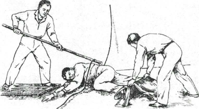 Ожоги электрическим током степени фото