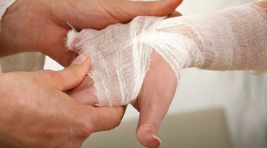 Ожоги электрическим током степени фото