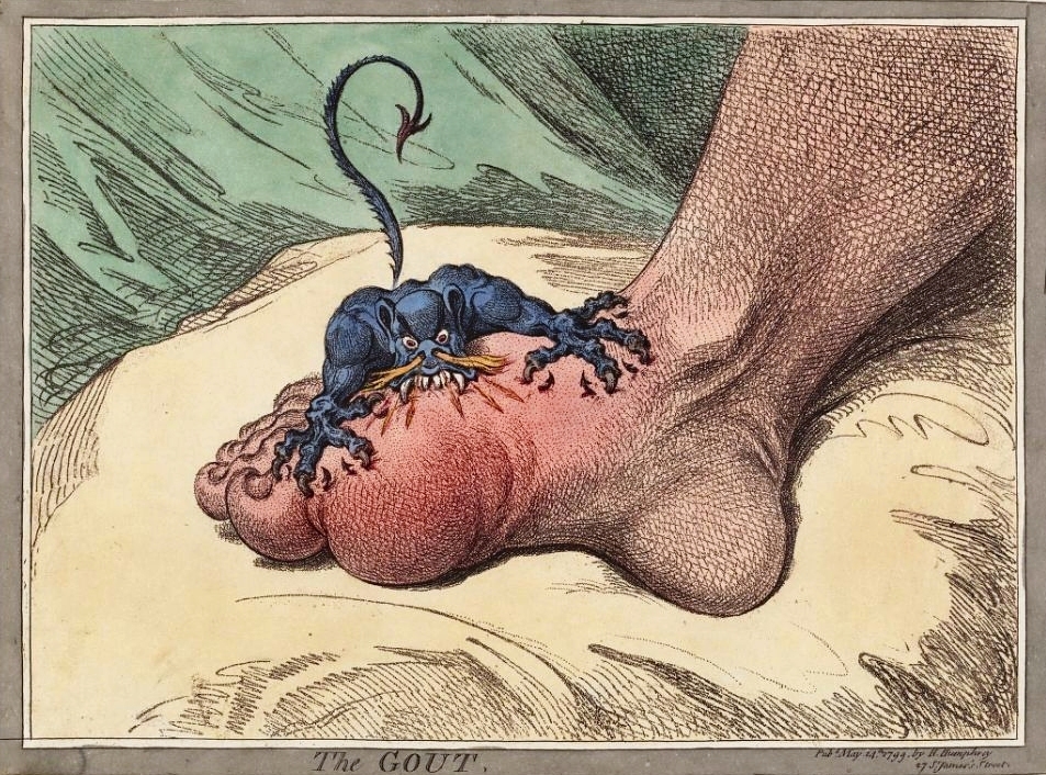 The_gout_james_gillray