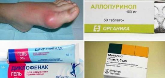 Аллопуринол