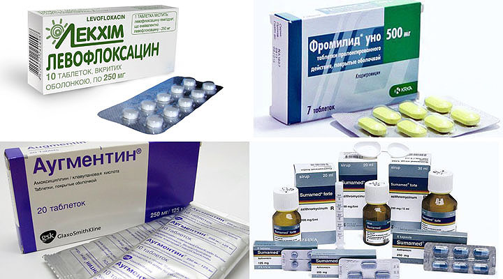 Обзор антибиотиков Обзор антибиотиков