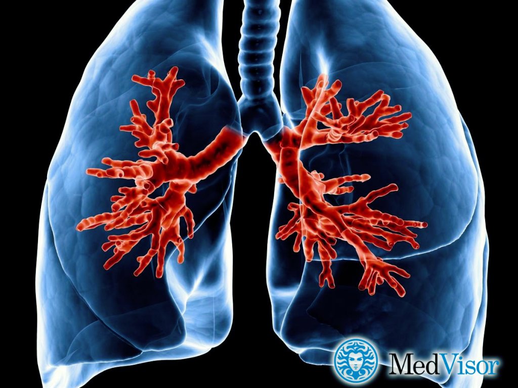 Острый бронхит Что хуже обструктивный бронхит или пневмония