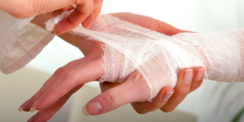 Что нужно делать когда получил ожог