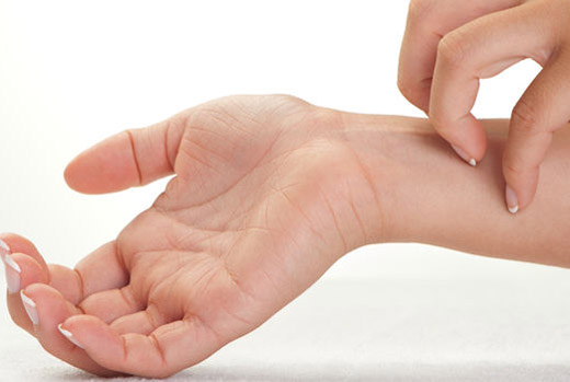 чешется ожог