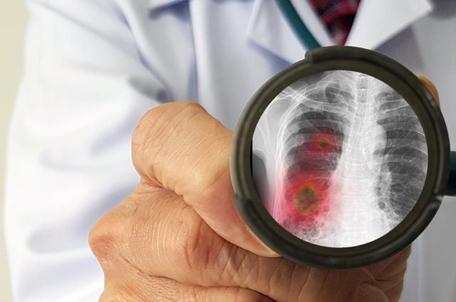 Процент летальных исходов при пневмонии