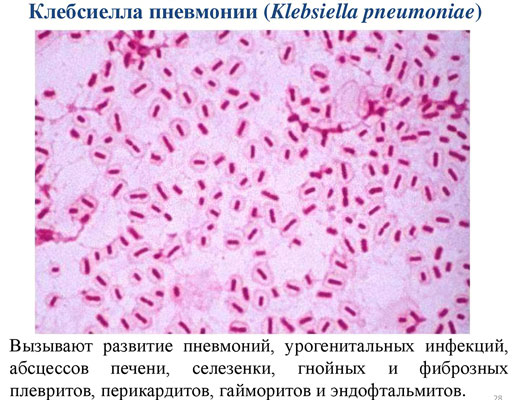 Клебсиелла Клебсиелла