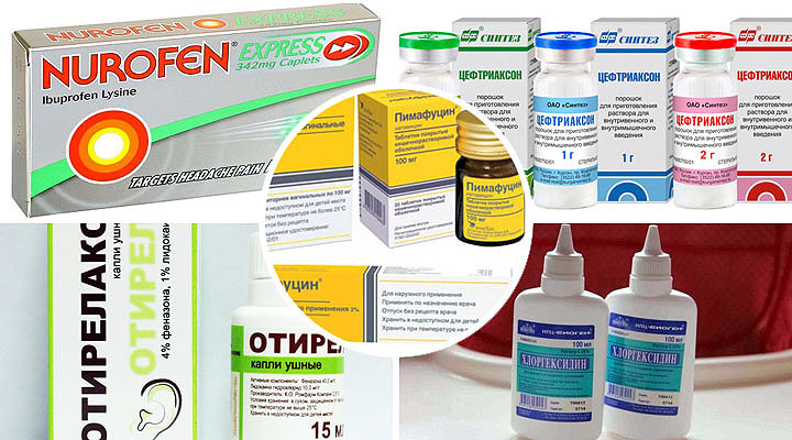 Для купирования симптомов патологи назначают следующие лекарства Медикаментозное лечение