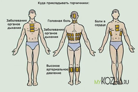 куда прикладывать горчичники