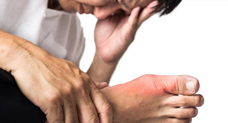 Лечение острого приступа Лечение острого приступа