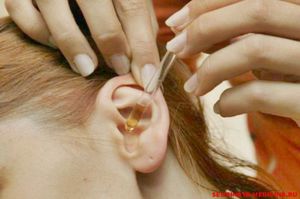 Лечение отита Лечение гнойного отита