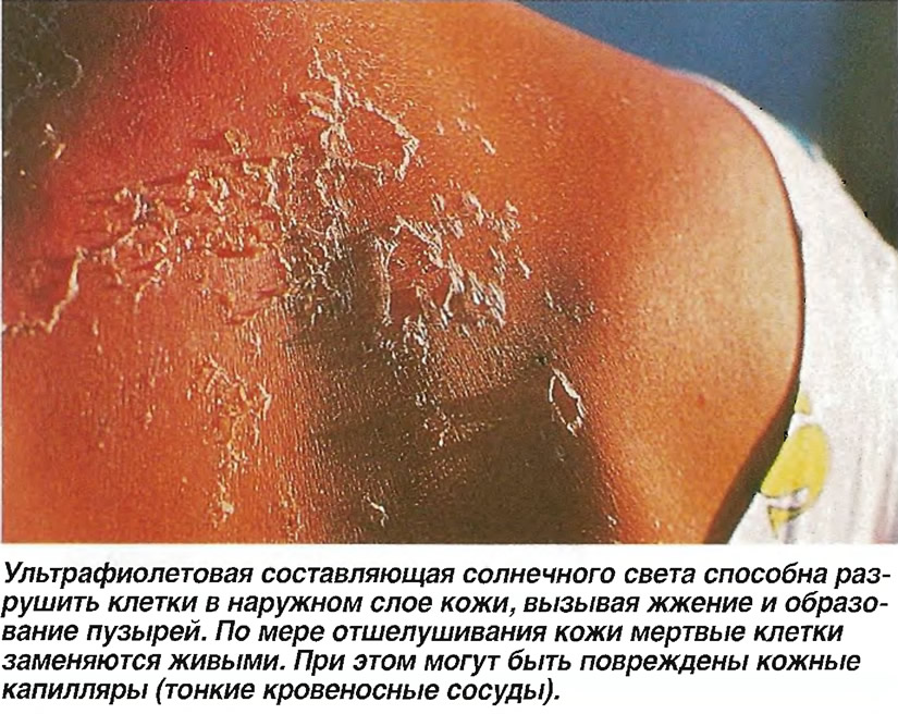 lechenie-v-domashnih-usloviyah