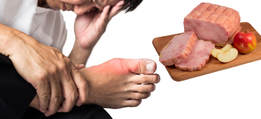 Употребление мяса при подагре Употребление мяса при подагре