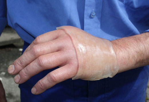 заживляющий силиконовый пластырь