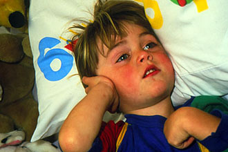 Отит у ребенка Отит у ребенка