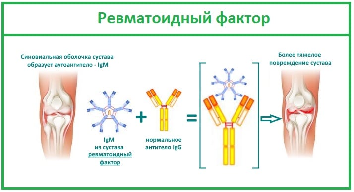 Подагра в коленном суставе лечение