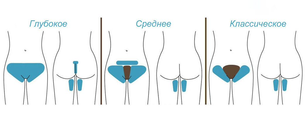 Зоны бикини